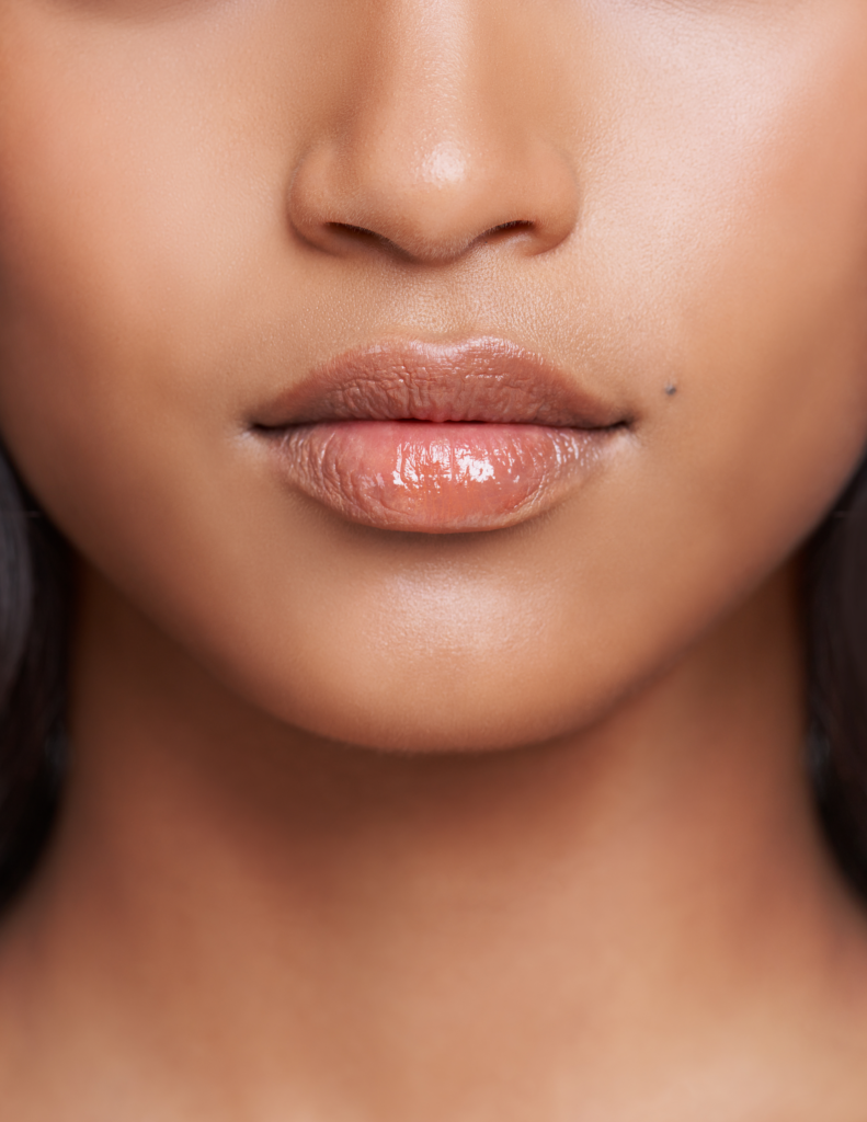 Woman with lip filler